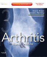 Anne C. Brower, Donald J. Flemming - Arthritis in Black and White, Inbunden