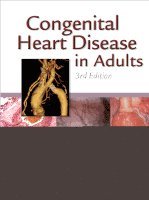 Joseph K. Perloff, John S. Child, Jamil Aboulhosn - Congenital Heart Disease in Adults, Inbunden