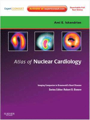 Atlas of Nuclear Cardiology: Imaging Companion to Braunwald's Heart Disease av Ami E Iskandrian, Ernest V Garcia