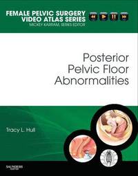 Posterior Pelvic Floor Abnormalities