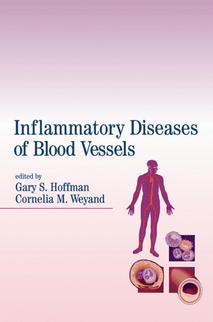 Cornelia M. Weyand, Gary S. Hoffman - Inflammatory Diseases of Blood Vessels, E-bok