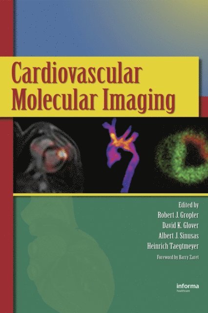 Albert J. Sinusas, David K. Glover, Robert J. Gropler - Cardiovascular Molecular Imaging, E-bok