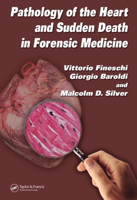 Malcolm D. Silver, Giorgio Baroldi, Vittorio Fineschi - Pathology of the Heart and Sudden Death in Forensic Medicine, E-bok. Tillgänglighet: Lägg i varukorg