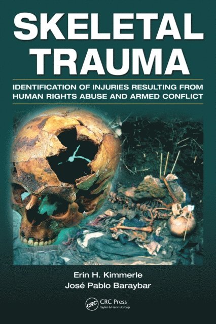 Jose Pablo Baraybar, Erin H. Kimmerle - Skeletal Trauma, E-bok. Tillgänglighet: Lägg i varukorg