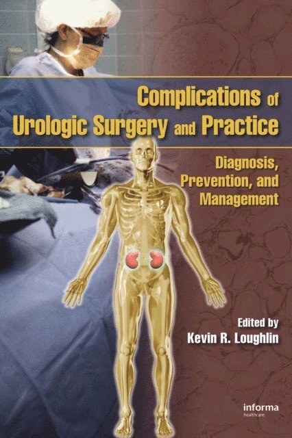 Kevin R. Loughlin - Complications of Urologic Surgery and Practice, E-bok
