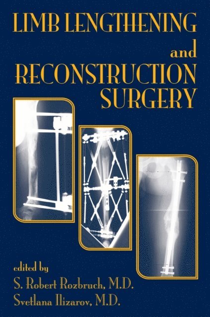 Svetlana Ilizarov, S. Robert Rozbruch - Limb Lengthening and Reconstruction Surgery, E-bok