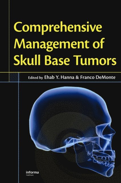 Franco DeMonte, Ehab Y. Hanna - Comprehensive Management of Skull Base Tumors, E-bok