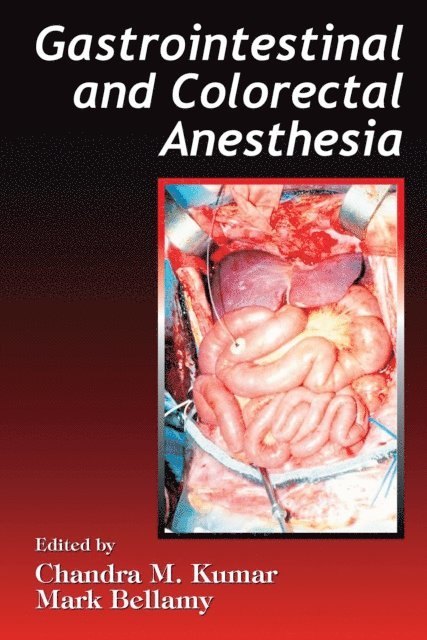 Mark Bellamy, Chandra M. Kumar - Gastrointestinal and Colorectal Anesthesia, E-bok