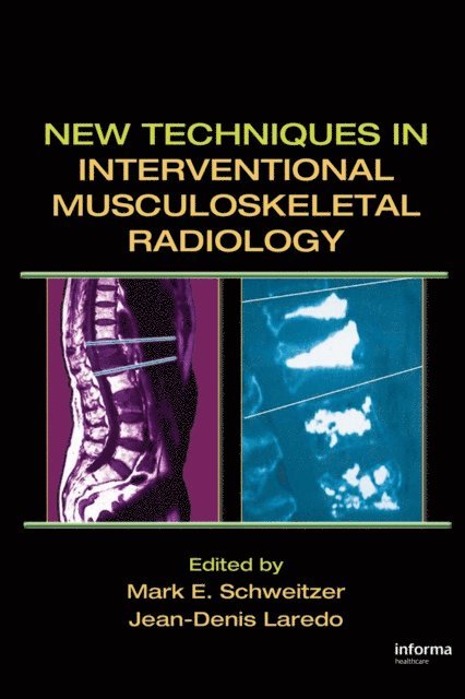 Jean-Denis Laredo, Mark E. Schweitzer - New Techniques in Interventional Musculoskeletal Radiology, E-bok