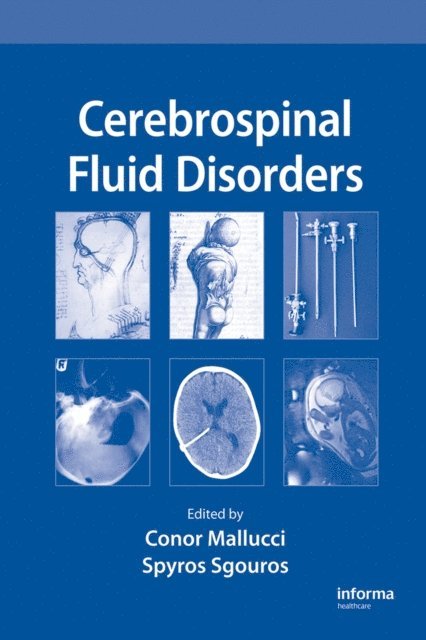 Spyros Sgouros, Conor Mallucci - Cerebrospinal Fluid Disorders, E-bok