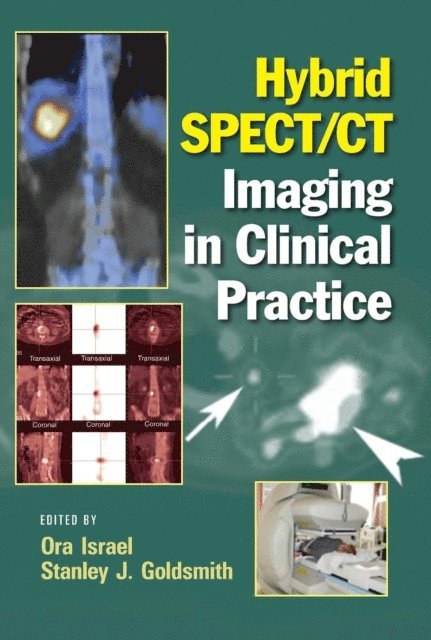 Stanley J. Goldsmith, Ora Israel - Hybrid SPECT/CT Imaging in Clinical Practice, E-bok