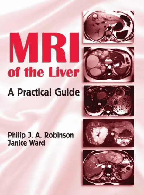 Janice Ward, Philip J. A. Robinson - MRI of the Liver, E-bok. Tillgänglighet: Lägg i varukorg