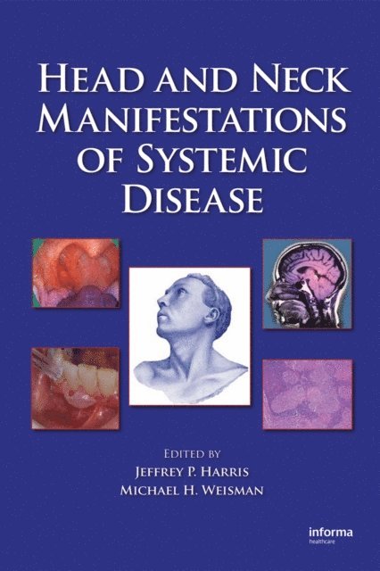 Michael H. Weisman, Jeffrey P. Harris - Head and Neck Manifestations of Systemic Disease, E-bok