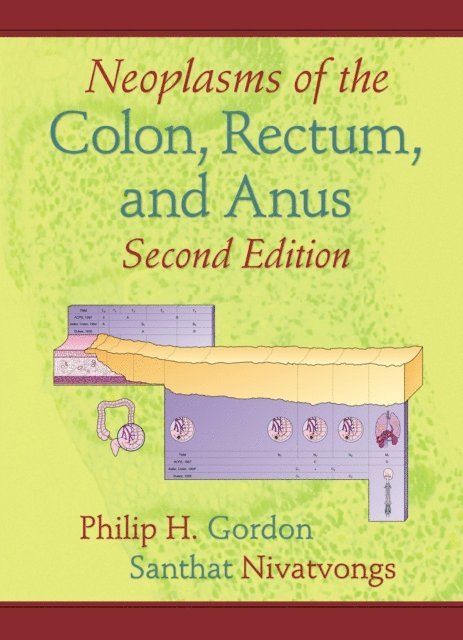 Santhat Nivatvongs, Philip H. Gordon - Neoplasms of the Colon, Rectum, and Anus, E-bok