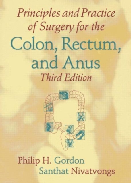 Santhat Nivatvongs, Philip H. Gordon - Principles and Practice of Surgery for the Colon, Rectum, and Anus, E-bok