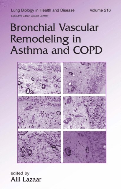 Aili Lazaar - Bronchial Vascular Remodeling in Asthma and COPD, E-bok. Tillgänglighet: Lägg i varukorg