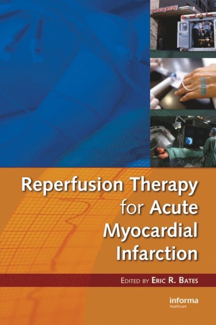 Eric R. Bates - Reperfusion Therapy for Acute Myocardial Infarction, E-bok