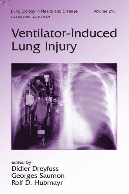 Rolf Hubmayr, Georges Saumon, Didier Dreyfuss - Ventilator-Induced Lung Injury, E-bok. Tillgänglighet: Lägg i varukorg