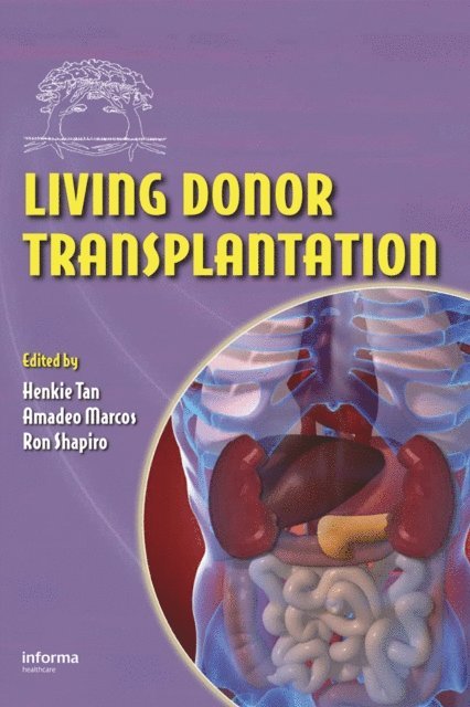 Ron Shapiro, Amadeo Marcos, Henkie P. Tan - Living Donor Transplantation, E-bok