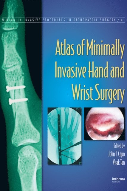 Virak Tan, John T. Capo - Atlas of Minimally Invasive Hand and Wrist Surgery, E-bok