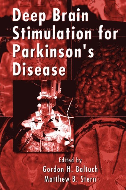 Matthew B. Stern, Gordon H. Baltuch - Deep Brain Stimulation for Parkinson's Disease, E-bok