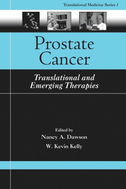 W. Kevin Kelly, Nancy A. Dawson - Prostate Cancer, E-bok
