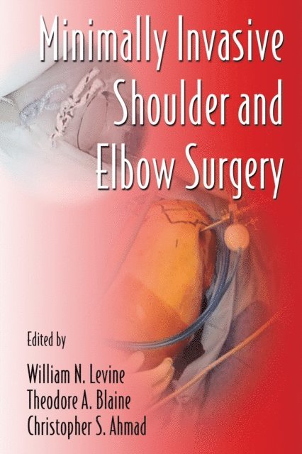 Christopher S. Ahmad, Theodore A. Blaine, William N. Levine - Minimally Invasive Shoulder and Elbow Surgery, E-bok