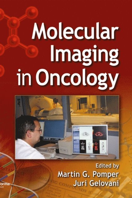 Juri G. Gelovani, Martin G. Pomper - Molecular Imaging in Oncology, E-bok