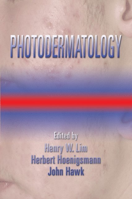 John L. M. Hawk, Herbert Honigsmann, Henry W. Lim - Photodermatology, E-bok