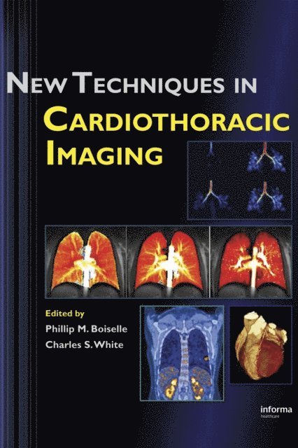 Charles S. White, Phillip M. Boiselle - New Techniques in Cardiothoracic Imaging, E-bok