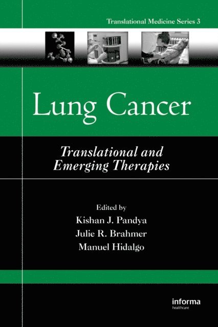 Manuel Hidalgo, Julie R. Brahmer, Kishan J. Pandya - Lung Cancer, E-bok. Tillgänglighet: Lägg i varukorg