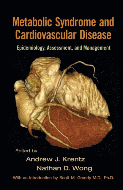 Nathan D. Wong, Andrew J. Krentz - Metabolic Syndrome and Cardiovascular Disease, E-bok