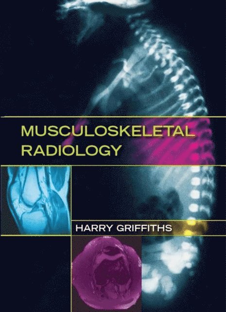 Harry Griffiths - Musculoskeletal Radiology, E-bok. Tillgänglighet: Lägg i varukorg