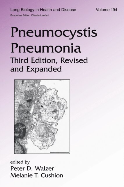 Melanie T. Cushion, Peter Walzer - Pneumocystis Pneumonia, E-bok