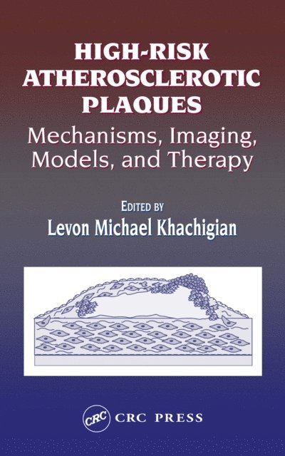 Levon Michael Khachigian - High-Risk Atherosclerotic Plaques, E-bok. Tillgänglighet: Lägg i varukorg