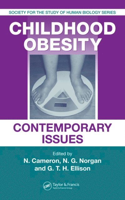 George Ellison, Gerard Hastings, Noel Cameron - Childhood Obesity, E-bok