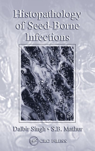 S. B. Mathur, Dalbir Singh - Histopathology of Seed-Borne Infections, E-bok. Tillgänglighet: Lägg i varukorg