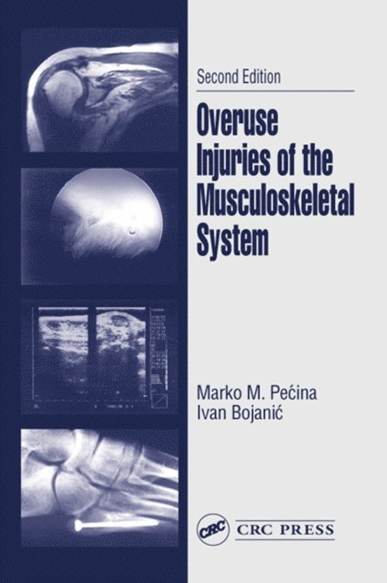Ivan Bojanic, Marko M. Pecina - Overuse Injuries of the Musculoskeletal System, E-bok
