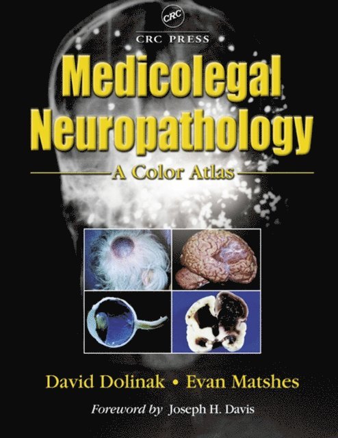 Evan W. Matshes, David Dolinak - Medicolegal Neuropathology, E-bok