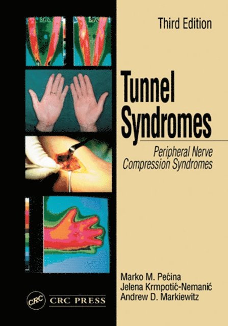 Jelena Krmpotic-Nemanic, Andrew D. Markiewitz, Marko M. Pecina - Tunnel Syndromes, E-bok