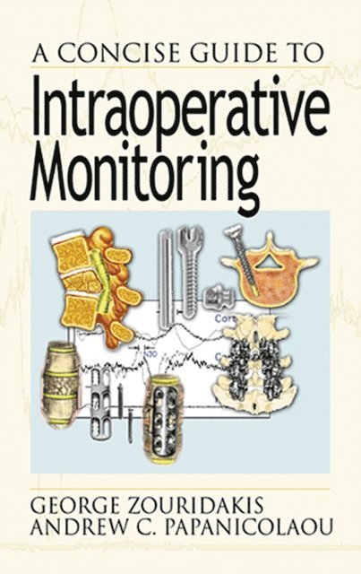 Andrew C. Papanicolaou, George Zouridakis - Concise Guide to Intraoperative Monitoring, E-bok