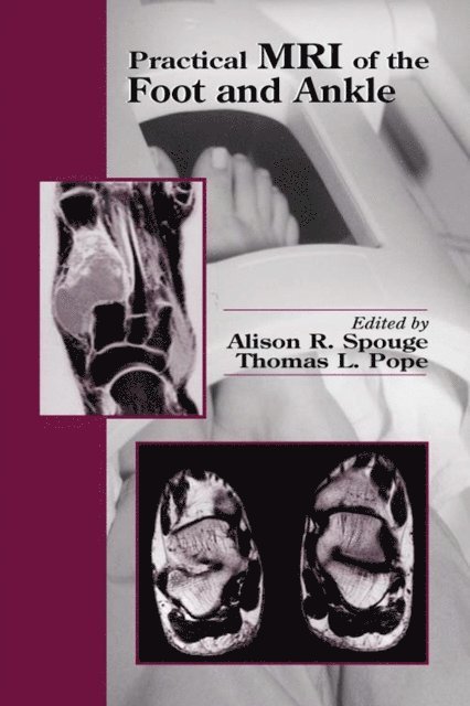 Thomas L Pope, Alison R. Spouge - Practical MRI of the Foot and Ankle, E-bok