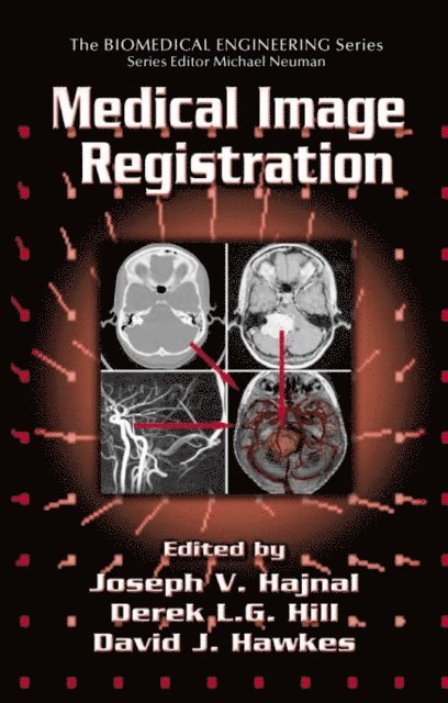 Derek L.G. Hill, Joseph V. Hajnal - Medical Image Registration, E-bok
