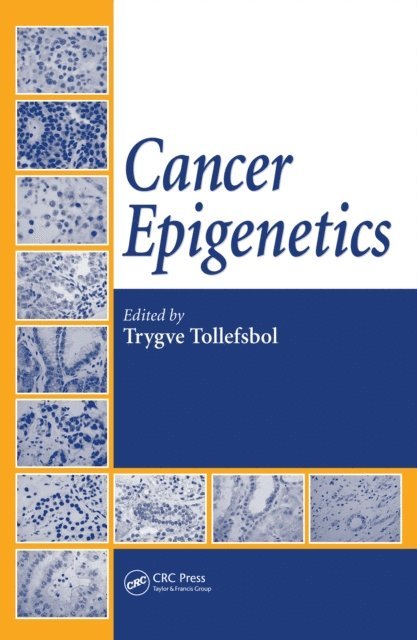 Trygve Tollefsbol - Cancer Epigenetics, E-bok