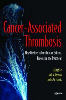 Alok A. Khorana, Charles W. Francis - Cancer-Associated Thrombosis, Inbunden. Tillgänglighet: Lägg i varukorg
