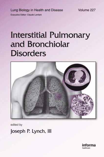 Joseph P. Lynch - Interstitial Pulmonary and Bronchiolar Disorders, E-bok