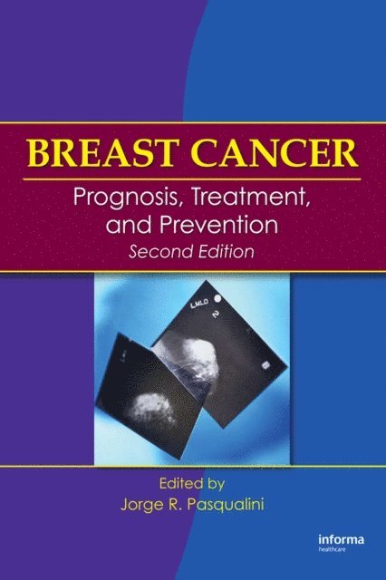 Jorge R. Pasqualini - Breast Cancer, E-bok