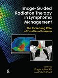 Image-Guided Radiation Therapy in Lymphoma Management