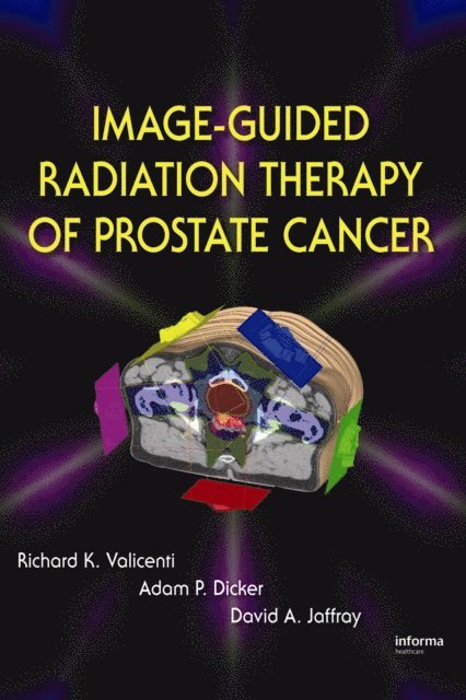 David A. Jaffray, Adam P. Dicker, Richard K. Valicenti - Image-Guided Radiation Therapy of Prostate Cancer, E-bok