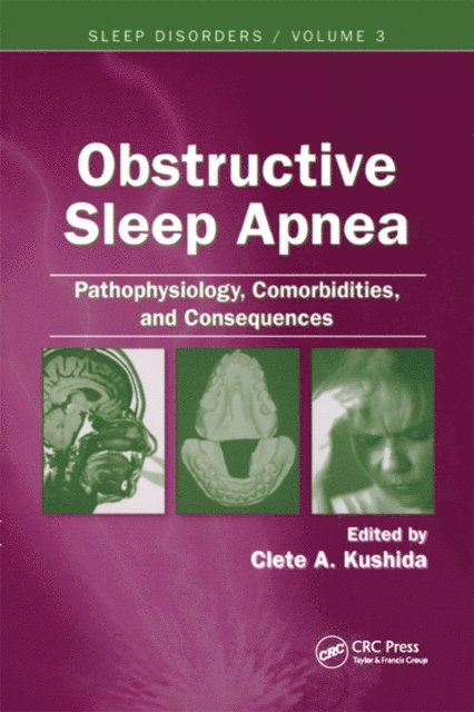 Clete A. Kushida - Obstructive Sleep Apnea, E-bok